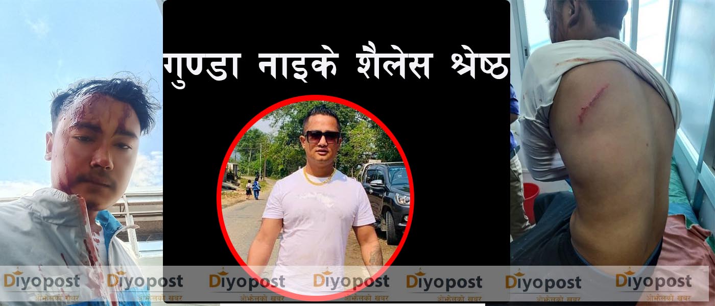 यी हुन् पत्रकार दिनेश बस्नेतमाथि सांघातिक आक्रमण गर्ने गुण्डा नाइके शैलेस श्रेष्ठ !