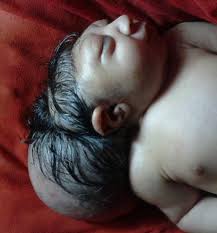 जनकपुरमा दुई मुख भएको शिशुको जन्म