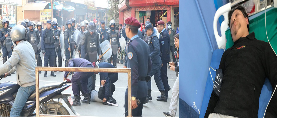 दशरथ रंगशालामा प्रहरीको लाठी, नागरिक दैनिकका पत्रकार घाइते