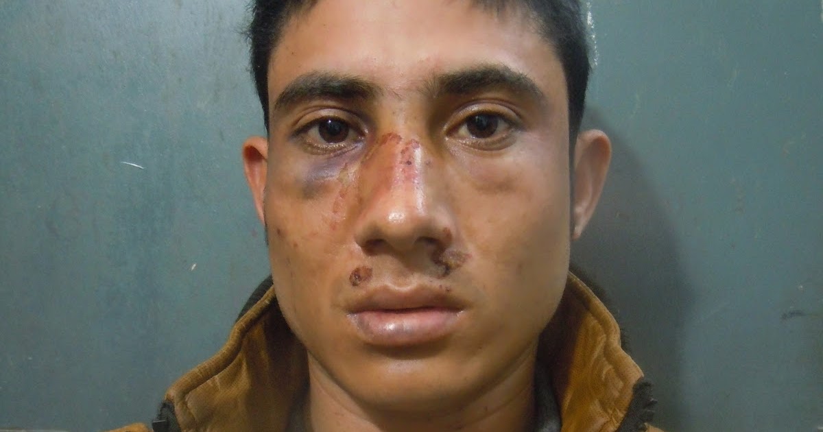 ७ बर्षअघि प्रचण्डलाई थप्पड हान्ने पदम कुँवर पुनः पक्राउ