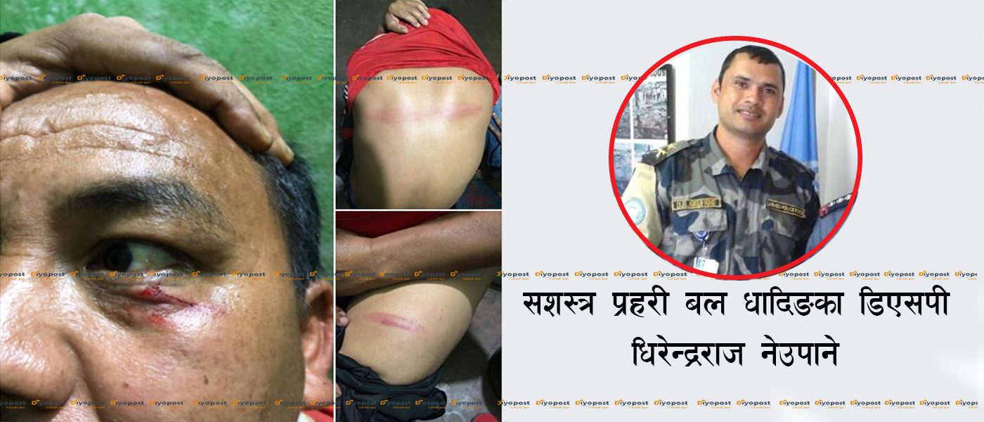 मजदुरमाथि निर्घात कुटपीट गर्ने सशस्त्र प्रहरीलाई कारबाही भएन, हेडक्वाटर नै बेखबर !