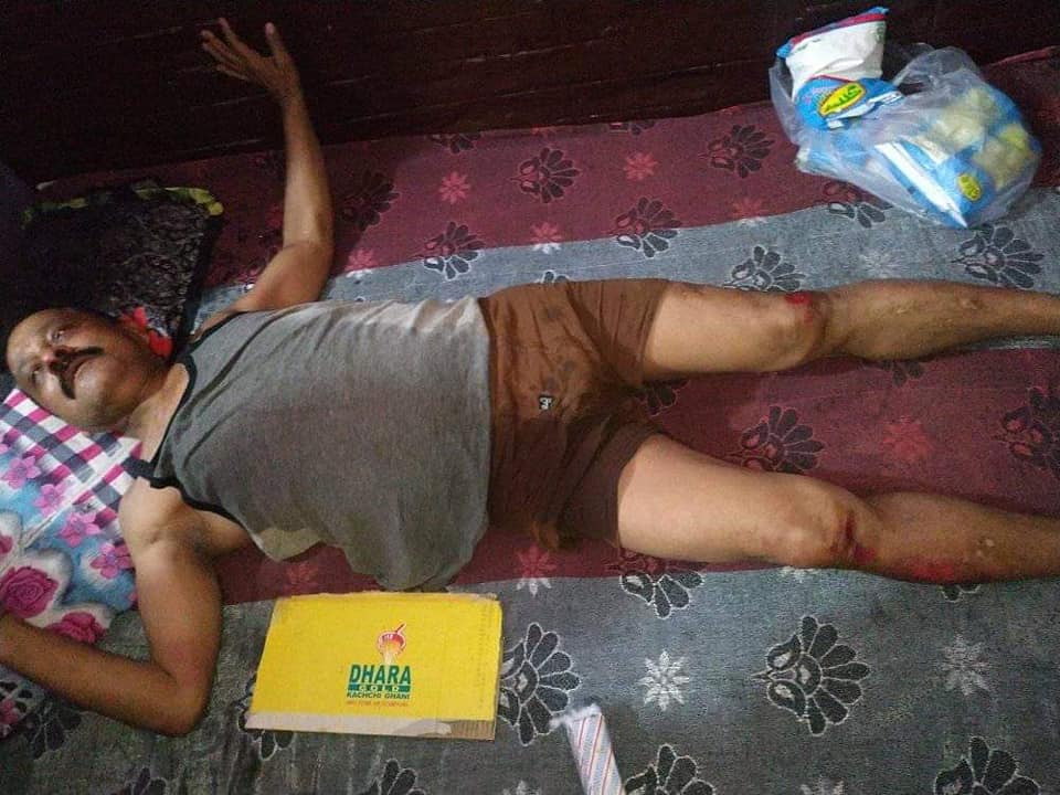 नेपालगञ्ज तनावमा प्रहरीको ज्यादती : ५६ वर्षीय व्यक्तिलाई घिसारेर २ सय मिटर परसम्म पुर्यायो !
