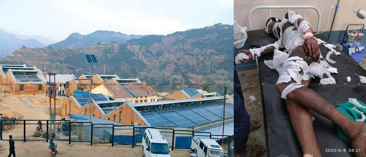 अस्पतालले कामबाट निकालेपछि आफ्नै शरीरमा आगो लगाएका मजदुरको मृत्यु !