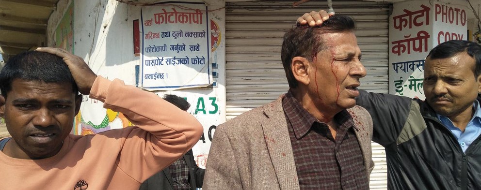 जनकपुरमा नेकपाका नेता रामचन्द्र झाको टाउकोमा प्रहरीको लाठी !