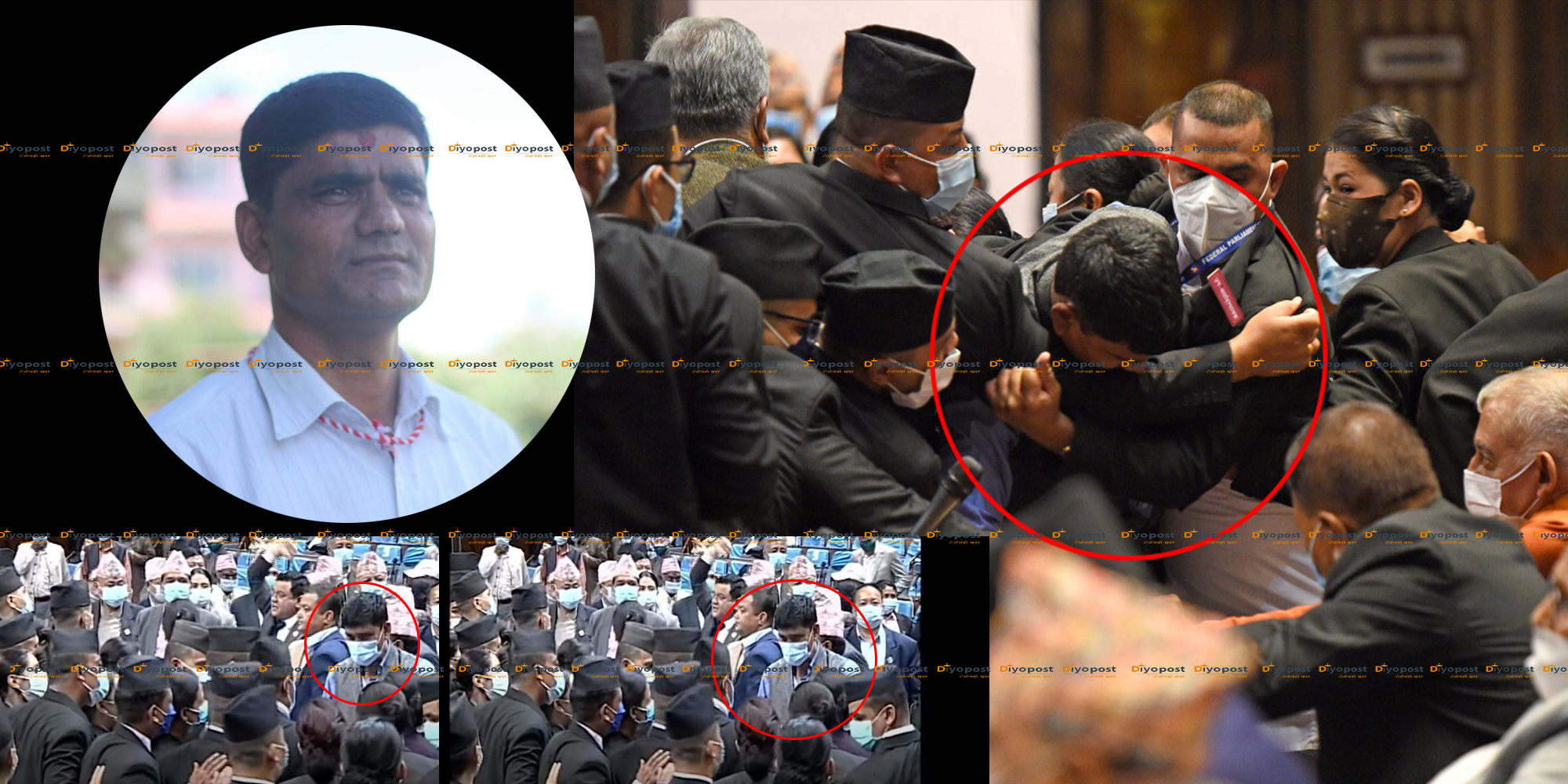 यी हुन् संसदमा मर्यादा पालकको पाखुरा टोक्ने एमाले सांसद (बयानसहित)