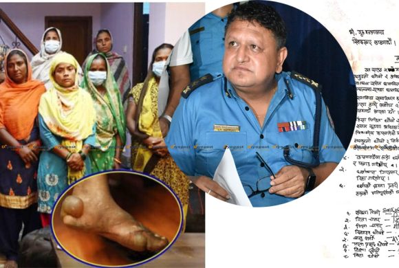 बाँकेका एसपी अधिकारीलाई कारबाही गर्न २० दिन हिँडेर काठमाडौं आउने पीडितको माग