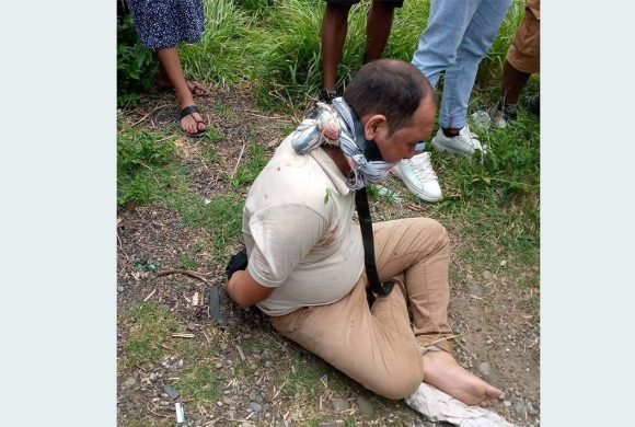 कैलालीमा एक जना कर्मचारीमाथि आक्रमण, आक्रमणकारीले गाडी र पैसा लुटे