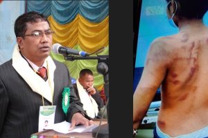 पाँच कक्षा पढ्ने बालकलाई प्रधानाध्यापकले यसरी कुटे