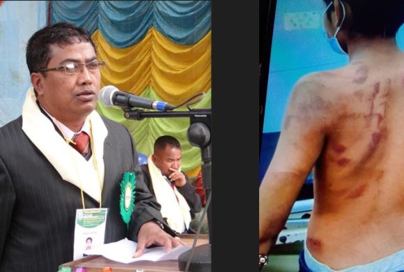 पाँच कक्षा पढ्ने बालकलाई प्रधानाध्यापकले यसरी कुटे