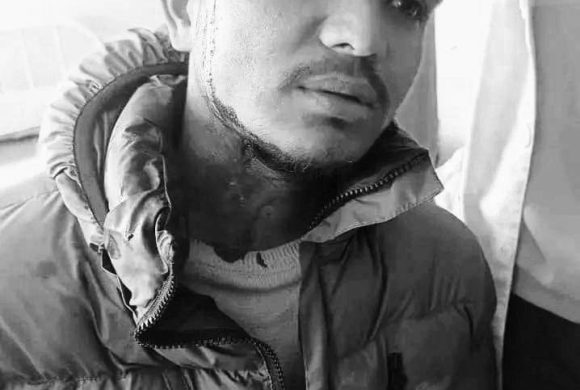 आरआर झडप  : आक्रमणमा संलग्नमाथि कारबाही गर्न माग