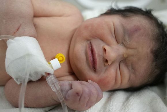 टर्की भुकम्प : परिवारका सबै सदस्य बिते तर सालनालसमेत नकाटिएको नवजात शिशु बाँचे