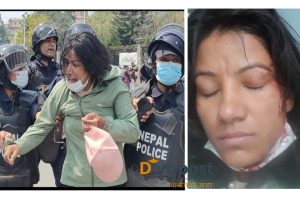 मिटरब्याज पीडितमाथि प्रहरीको ज्यादतीः टाउको फुटाइएका घाइतेलाई समेत हिरासतमा राखेर यातना !