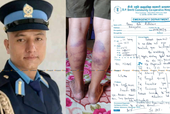 सेवाग्राहीमाथि बसपार्कका ईन्सपेक्टर दिनेश गुरुङ्गद्वारा निर्घात कुटपीट (भिडियोसहित)