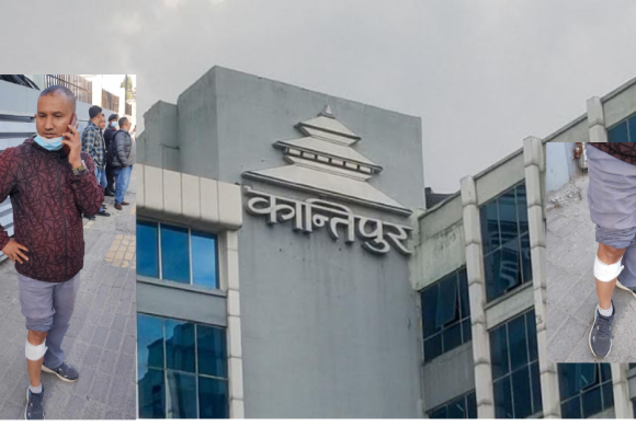 कान्तिपुरद्वारा आन्दोलनकारी पत्रकारमाथि ‘भिजलान्ते’ प्रयोग गरि आक्रमण, टिकाराम प्रधान घाइते