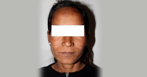 अछाममा युवकको हत्या गरी फरार महिला काठमाडौंबाट पक्राउ