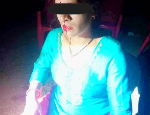 दैलेखमा धारामा पनी भर्न गएकी दलित महिलामाथि कुटपीट