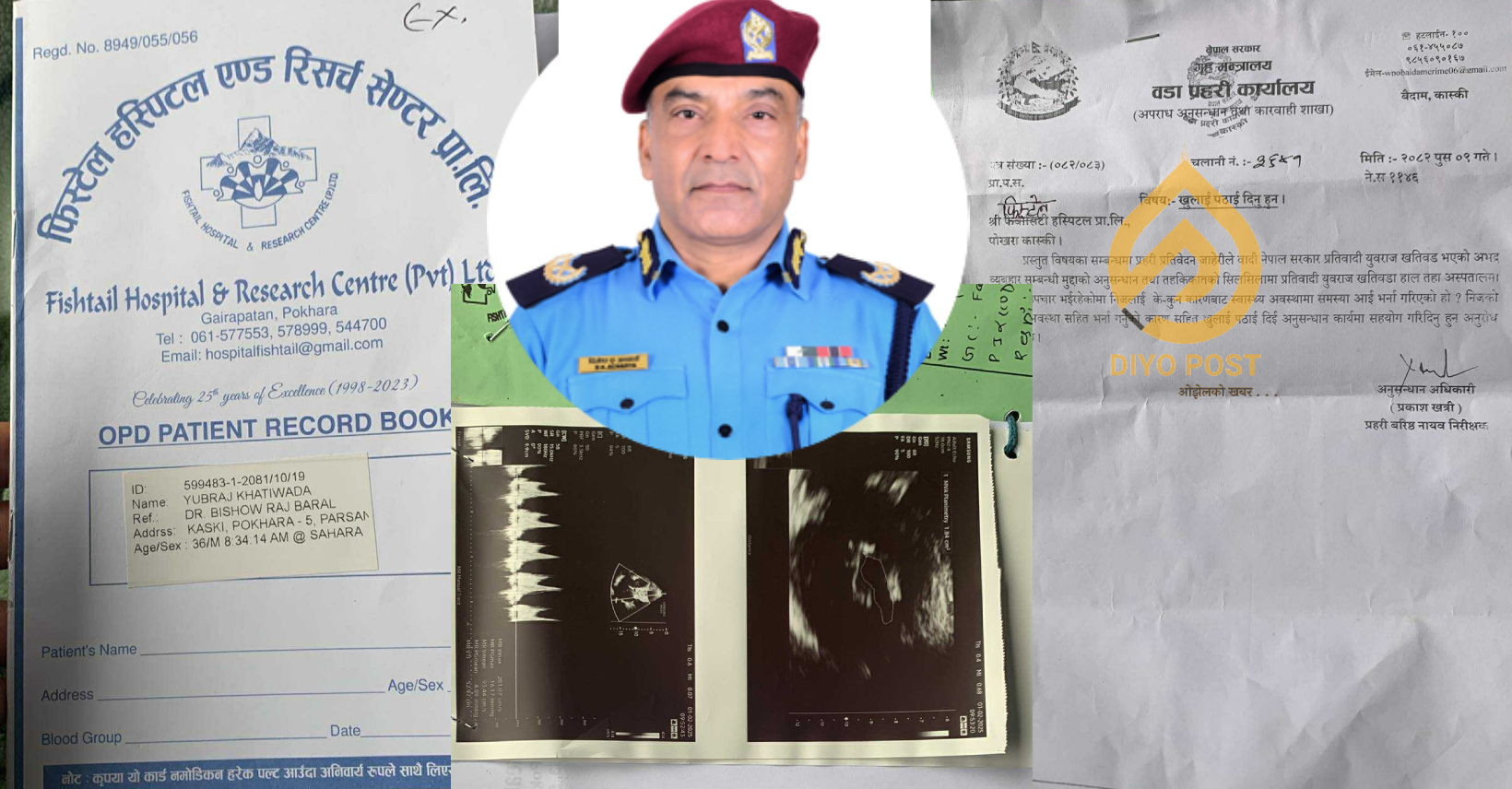 मुटुका भल्व फेरेका विरामीको जीवनमाथि डिआइजी आचार्यको खेलवाड, जबरजस्ती डिस्चार्ज !