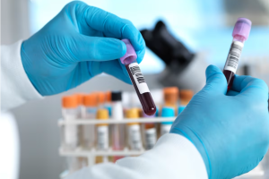 जलवायु प्रदूषणको नयाँ खतरा: के बढ्दो कार्बनडाइअक्साइडले हाम्रो रगतको रसायन परिवर्तन गर्दैछ?