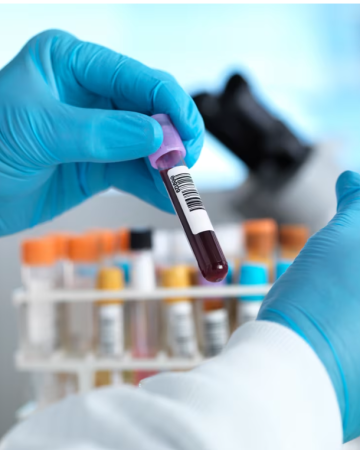 जलवायु प्रदूषणको नयाँ खतरा: के बढ्दो कार्बनडाइअक्साइडले हाम्रो रगतको रसायन परिवर्तन गर्दैछ?