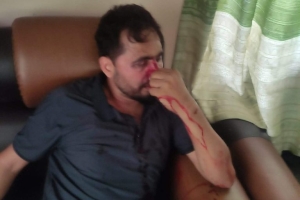 तिलोत्तमा ३ को वडा कार्यालयमा सेवाग्राहीमाथि दिनदहाडै कुटपिट