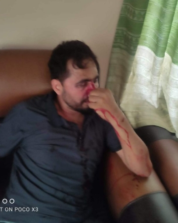 तिलोत्तमा ३ को वडा कार्यालयमा सेवाग्राहीमाथि दिनदहाडै कुटपिट