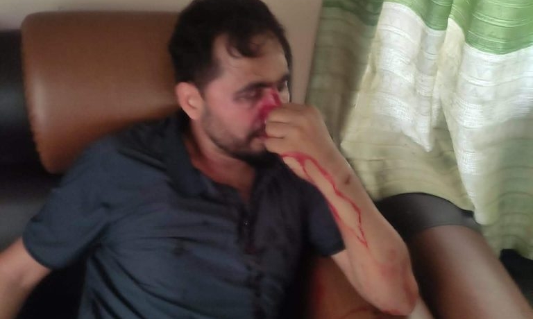 तिलोत्तमा ३ को वडा कार्यालयमा सेवाग्राहीमाथि दिनदहाडै कुटपिट