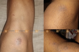 मुग्लिनका प्रहरी निरीक्षक सिंहमाथि नाबालकलाई यातना दिएको आरोप, छानबिनको माग