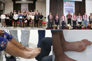 नेपालमै पहिलो पटक ‘फुट एण्ड एंकल डिफर्मिटी करेक्शन’ कोर्ष सम्पन्न, ८ बिरामीको निःशुल्क शल्यक्रिया