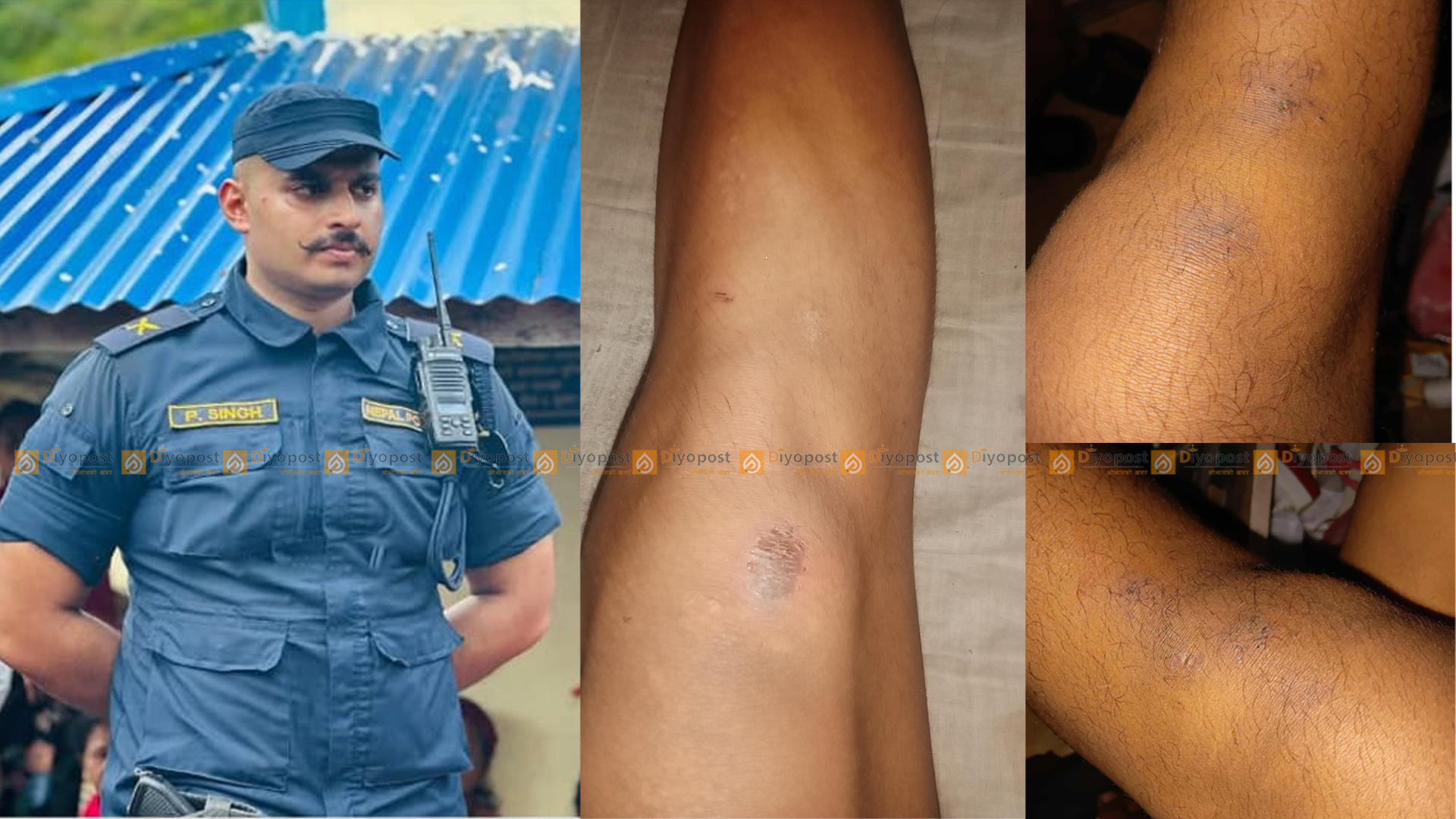 मुग्लिनका प्रहरी निरीक्षक सिंहमाथि नाबालकलाई यातना दिएको आरोप, छानबिनको माग