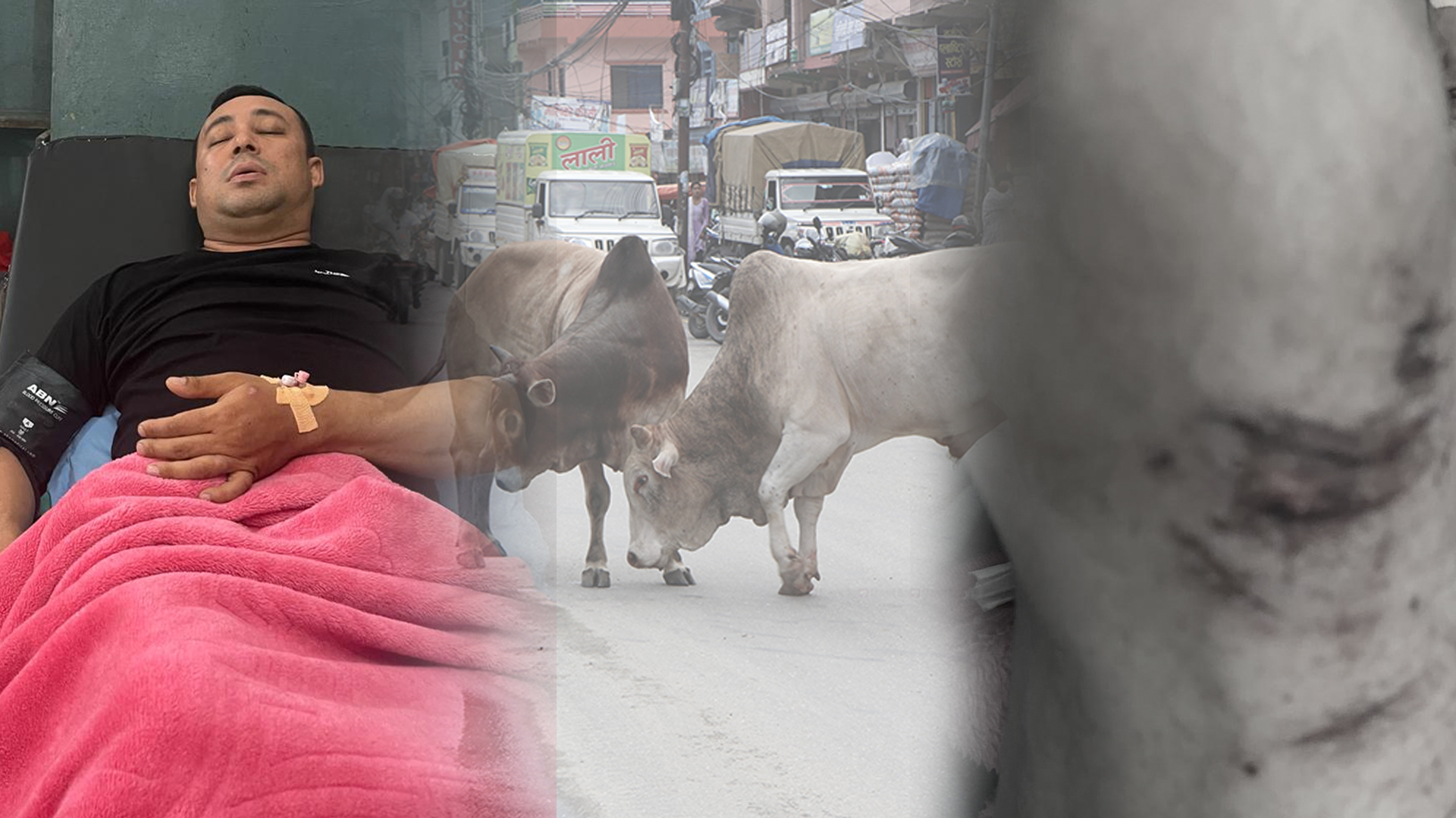 बुटवलमा छाडा चौपाया आतंकः साँडेको आक्रमणबाट एक युवक गम्भीर घाइते, पाँच करङ भाँचिए