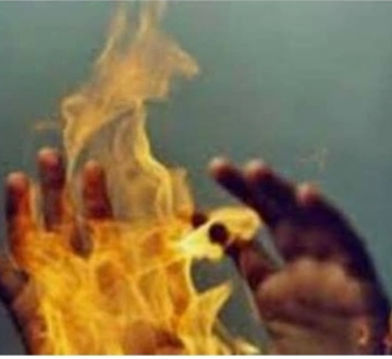 रौतहटमा युवकद्वारा आत्मदाहको प्रयास, वीर अस्पतालको आईसीयूमा उपचार जारी