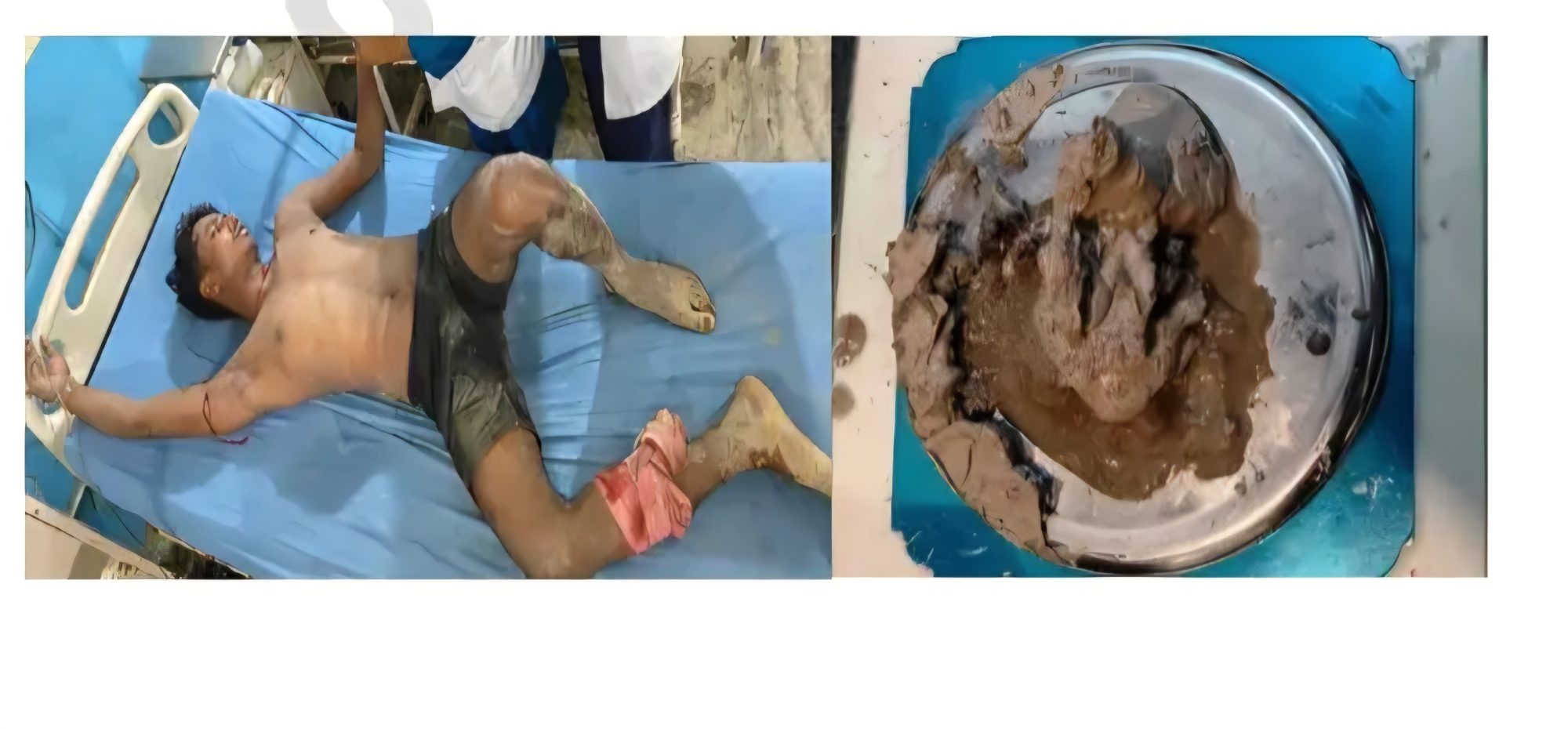 सिरहामा गोली चल्यो, ब्राउनसुगरसहित भारतीय लागूऔषध कारोबारी पक्राउ